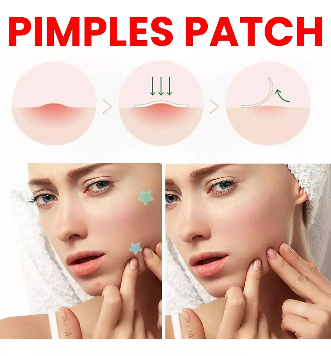 Parches Para Acné O Espinillas En Forma De Estrella 200 Pat - Imagen 4