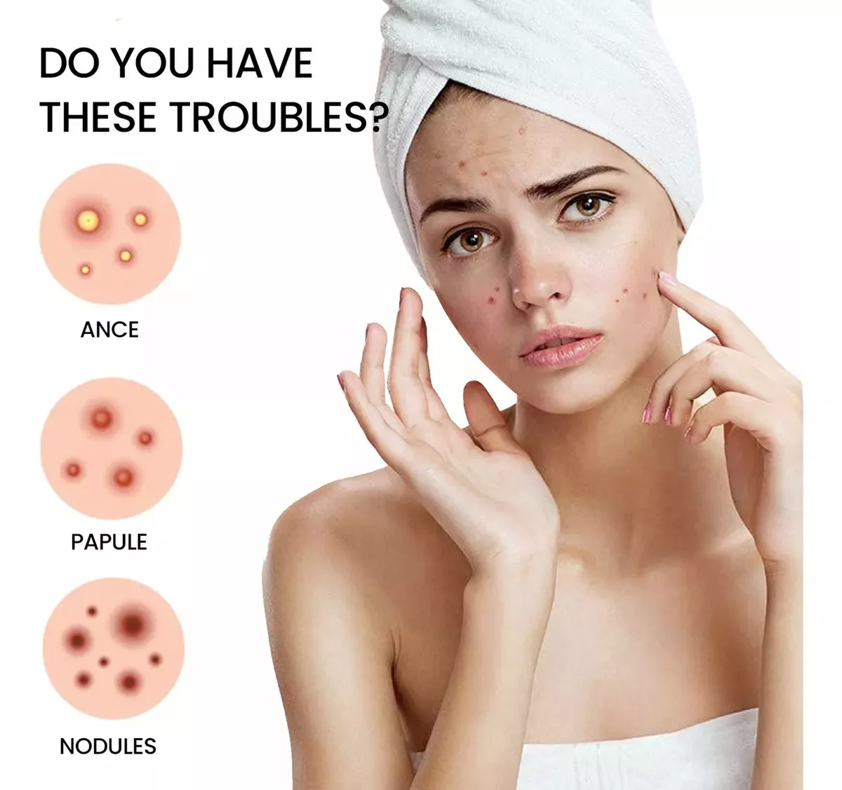 Parches Para Acné O Espinillas En Forma De Estrella 200 Pat - Imagen 2