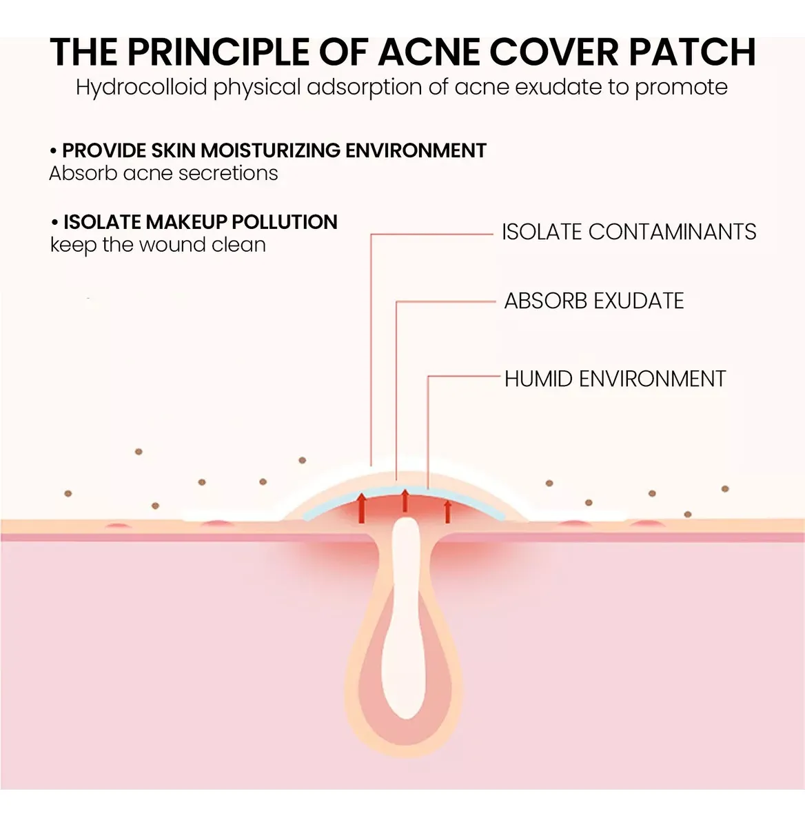 Parches Para Acné O Espinillas En Forma De Estrella 200 Pat - Imagen 6